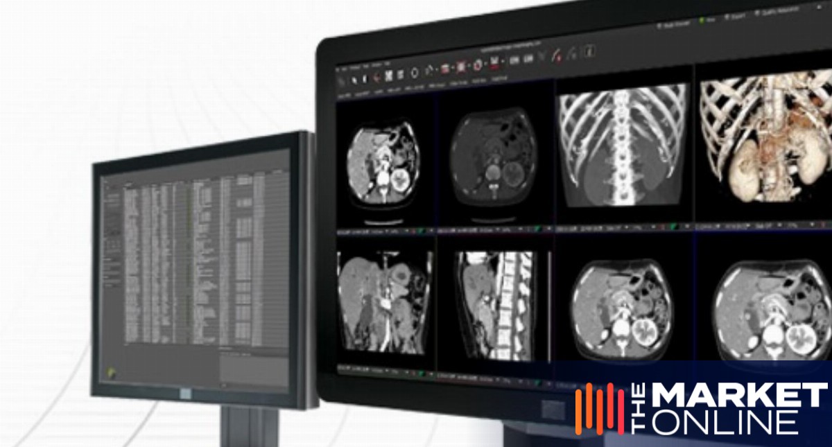 Pro Medicus signs $44M in health contracts